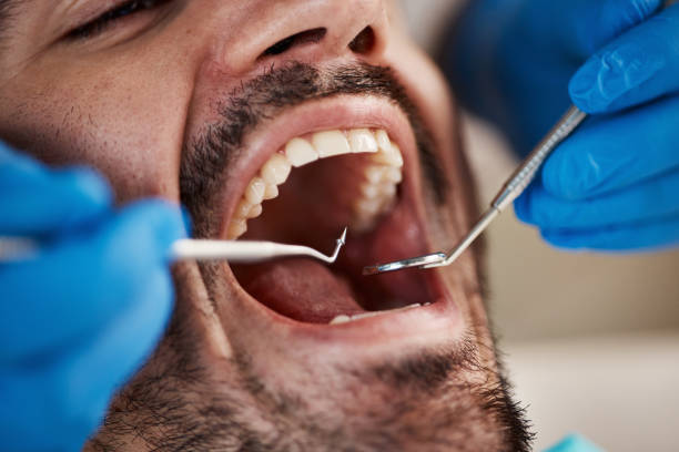 Trusted CA Emergency Dentist Experts